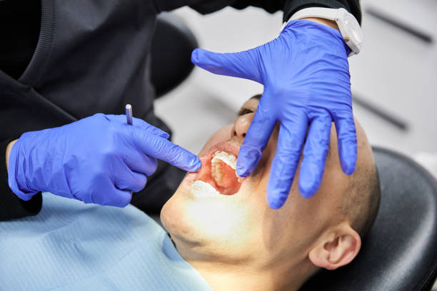 Best Emergency Dental Care for Broken or Chipped Teeth in Colstrip, MT